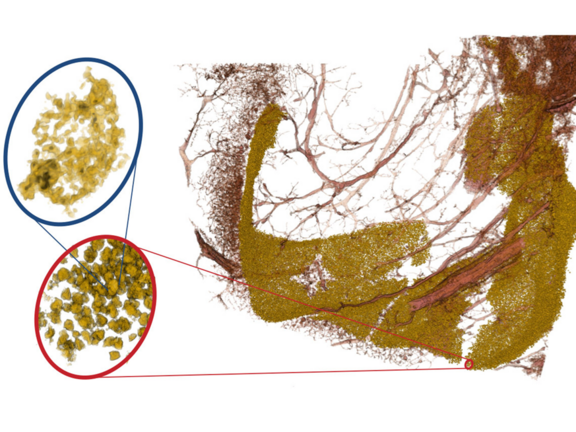3D visualisation of human neuronal tissue reconstructed by multi-scale X-ray phase contrast tomography. Neuronal cell nuclei are shown in yellow for the granule neurons in the dentate gyrus region of the hippocampus. Blood vessels are shown in red. By changing the X-ray optical magnification in the multi-scale recordings, one can zoom   into regions-of-interest (red ovals). In these scans the resolution is high enough to resolve sub-structures of the nucleus, associated with different DNA packing regimes. Adapted from [6]